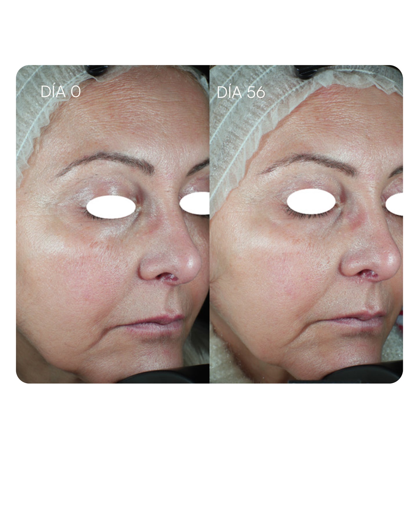 IN-898 ANTIEDAD Complemento alimenticio