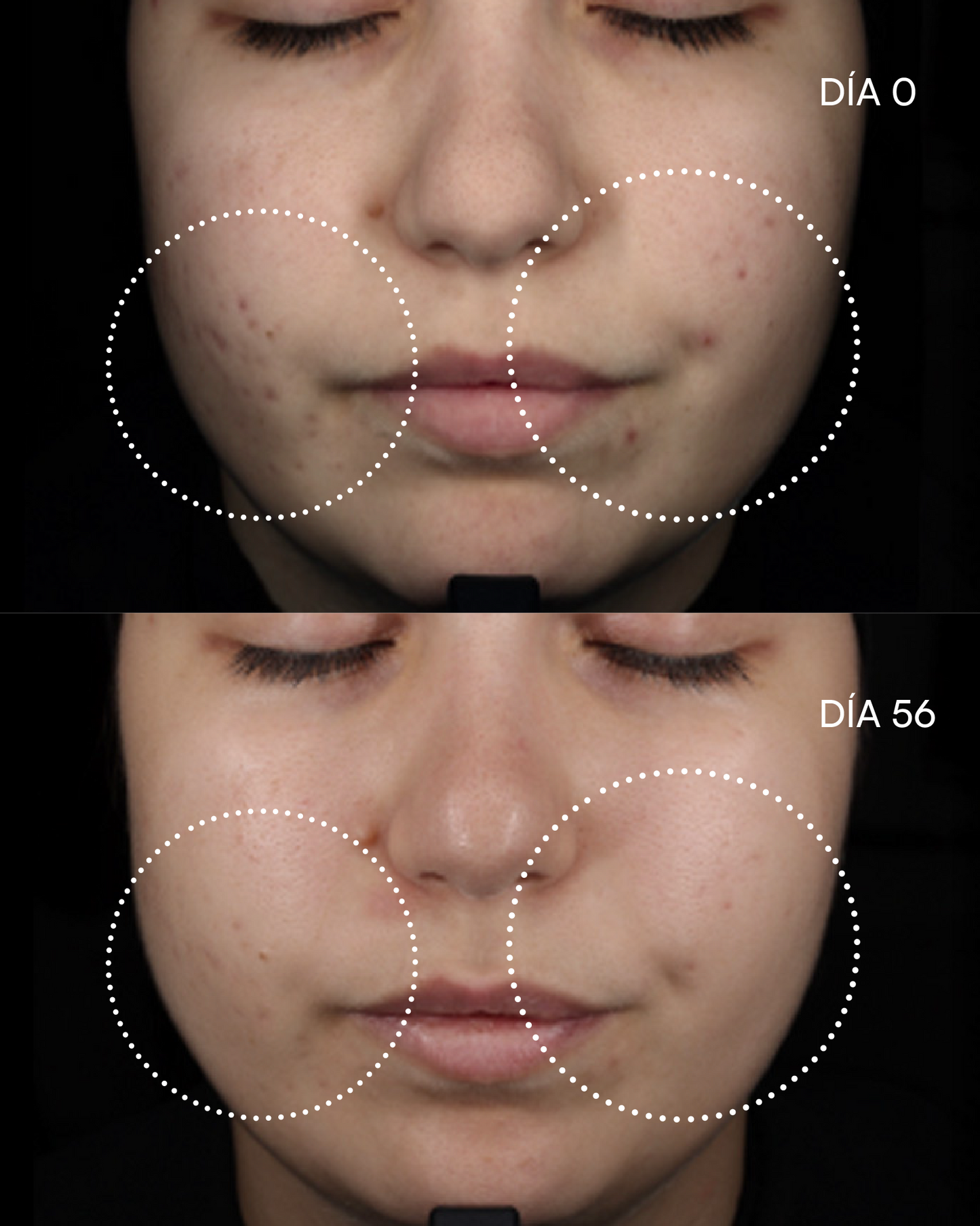 12 AZELAIC-N Sérum imperfecciones - imagen 6
