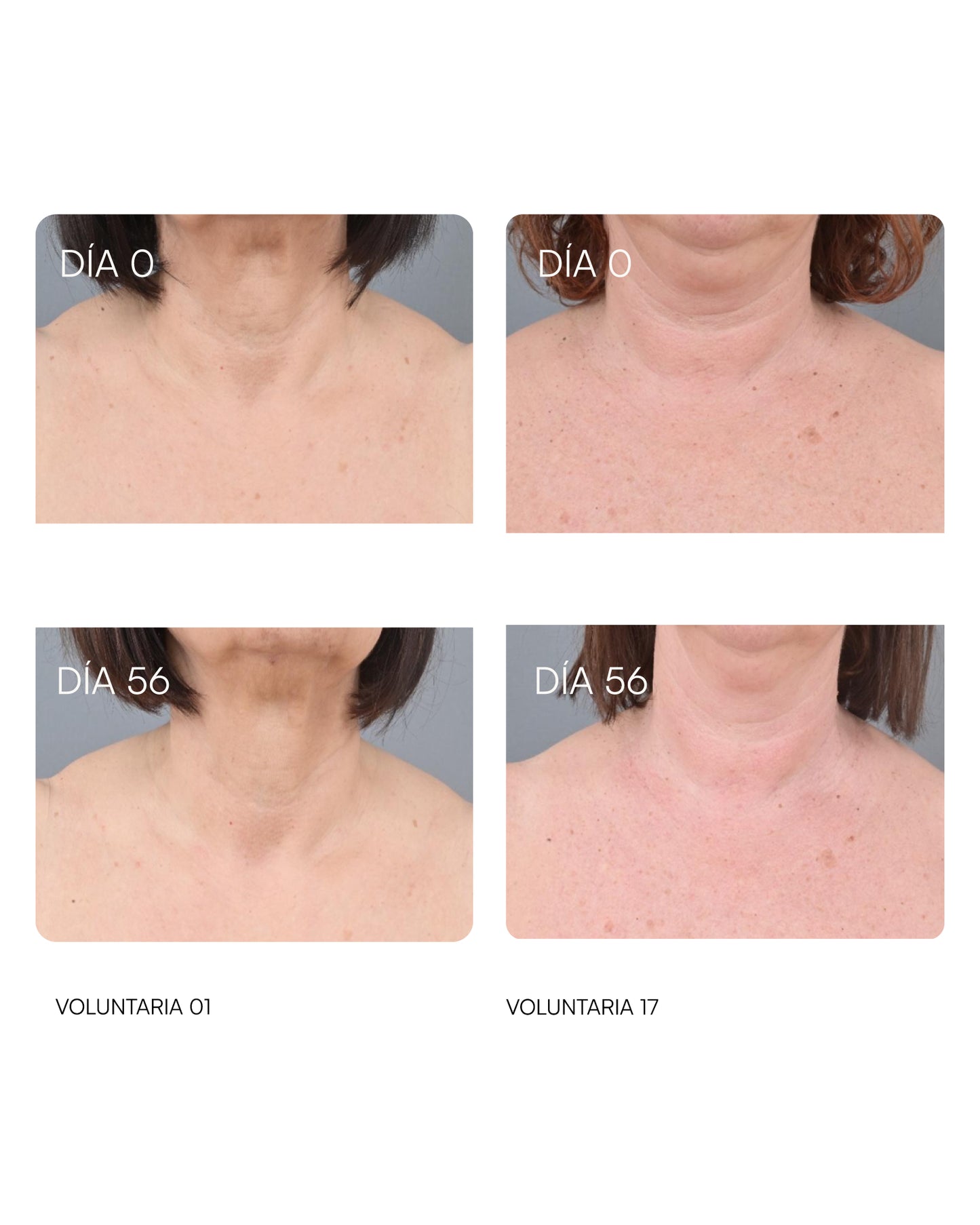 25 PÉPTIDOS-TH Cremagel roll-on para cuello y escote