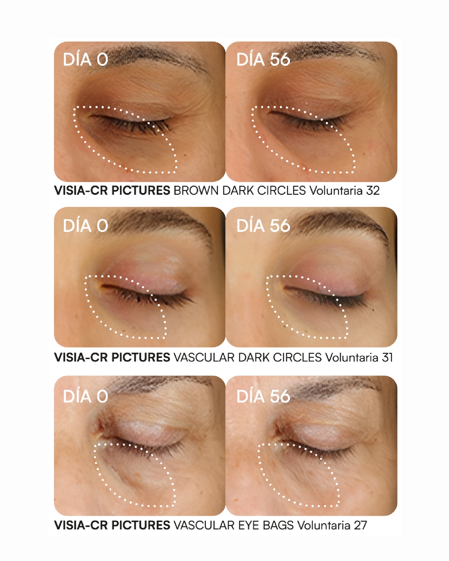 K-AT SÉRUM Contorno de ojos para ojeras y bolsas