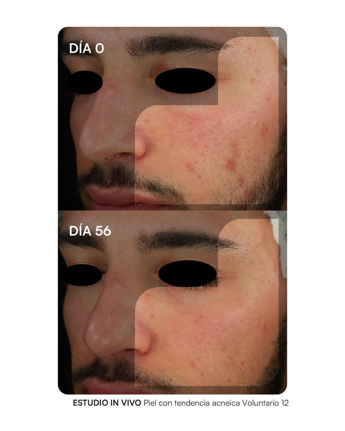 PROBIODERM BALANCE Complemento alimenticio