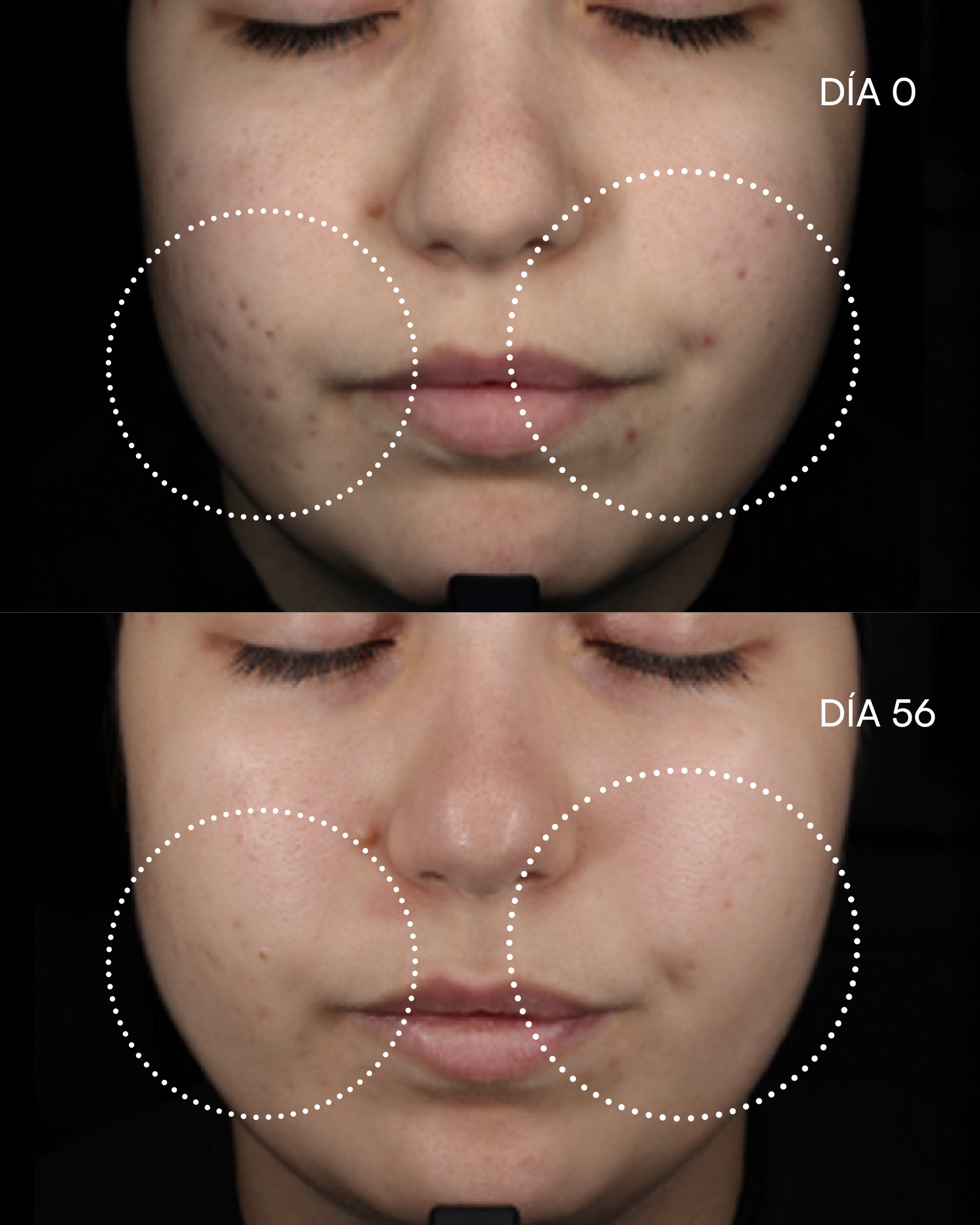 12 AZELAIC-N Sérum imperfecciones - imagen 6