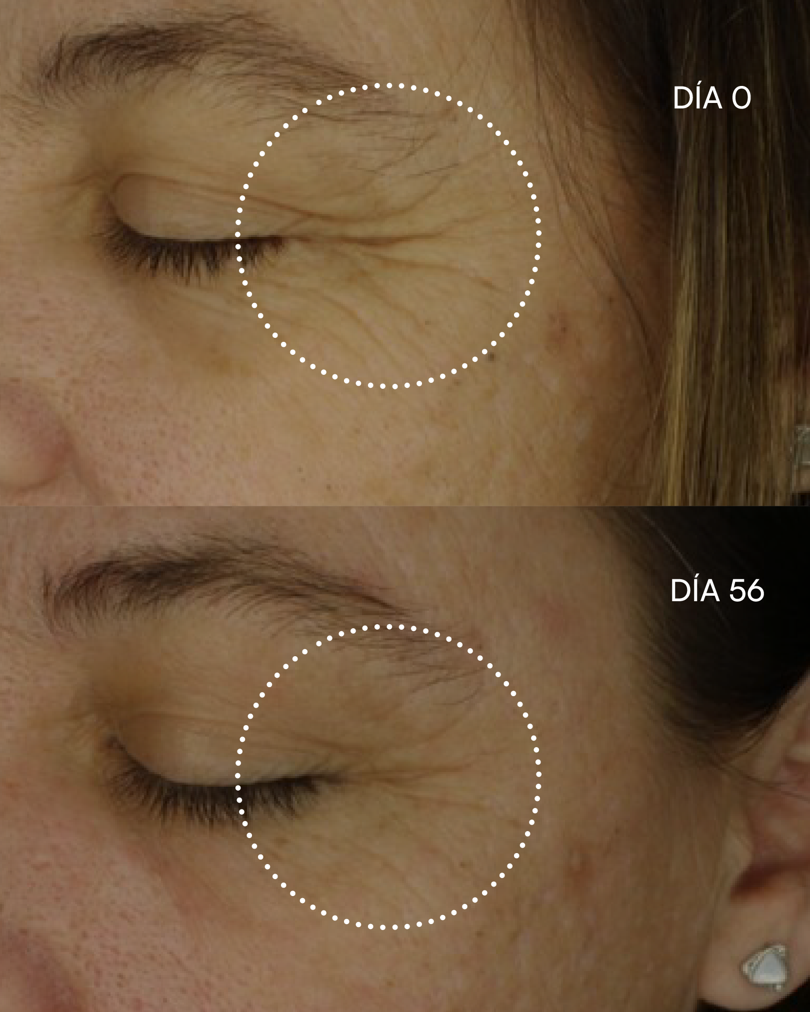 3000 RETINOL -NP Sérum antiedad - imagen 7