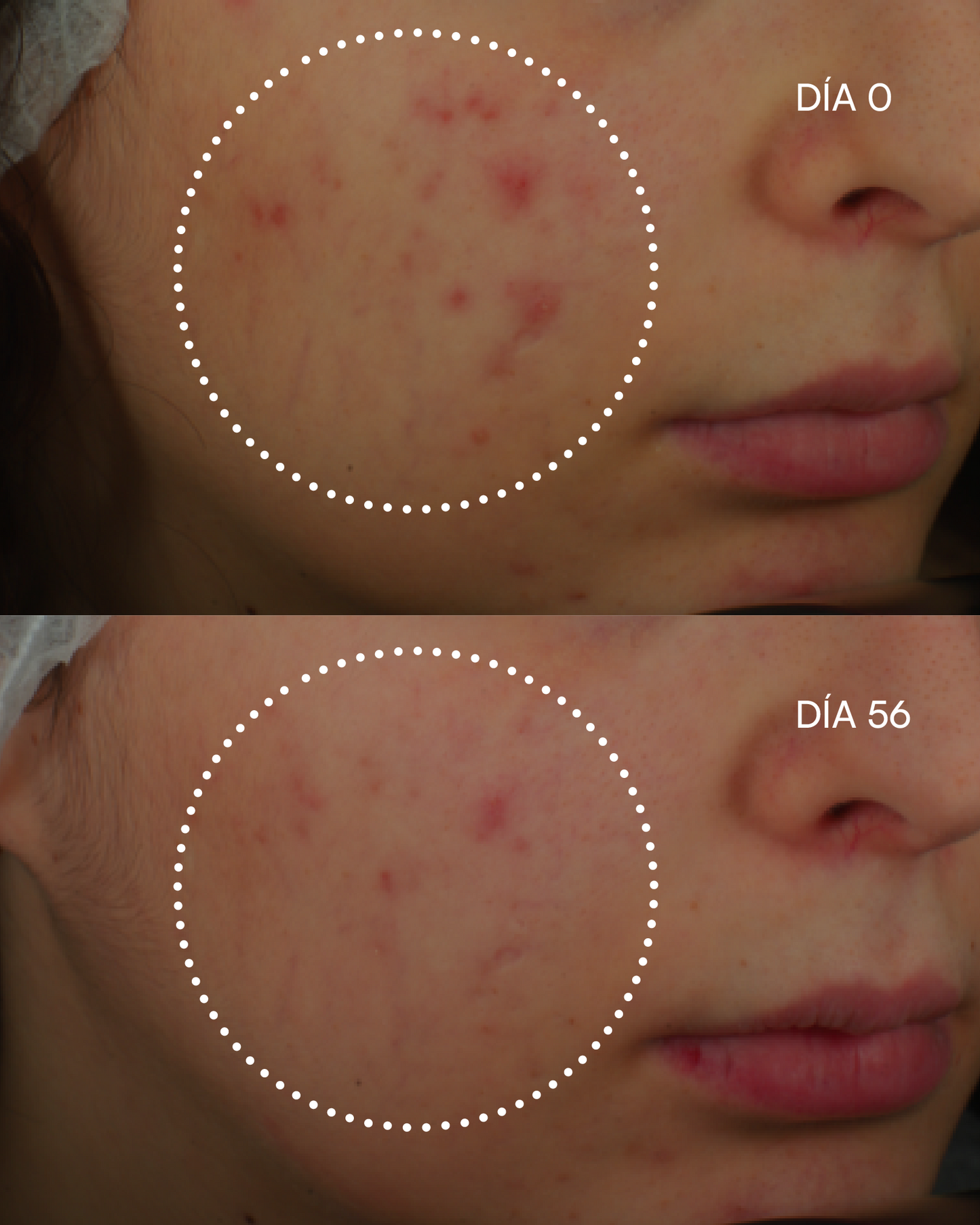 1600 RETINAL-Z sérum imperfecciones - imagen 6