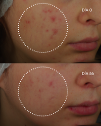 1600 RETINAL-Z sérum imperfecciones - imagen 6