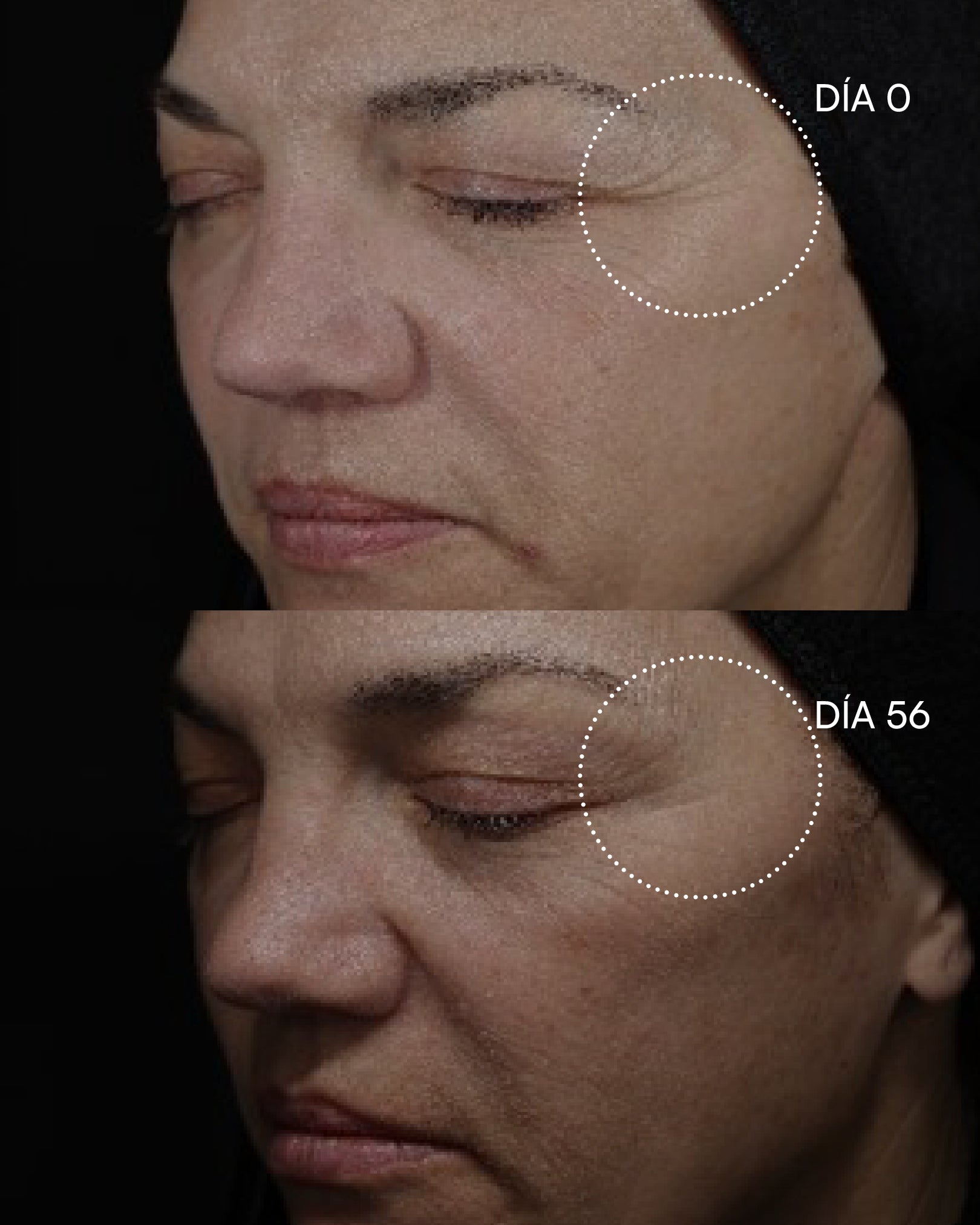 PEELING 20 AHA Discos intensivos - imagen 6