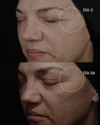 PEELING 20 AHA Discos intensivos - imagen 6